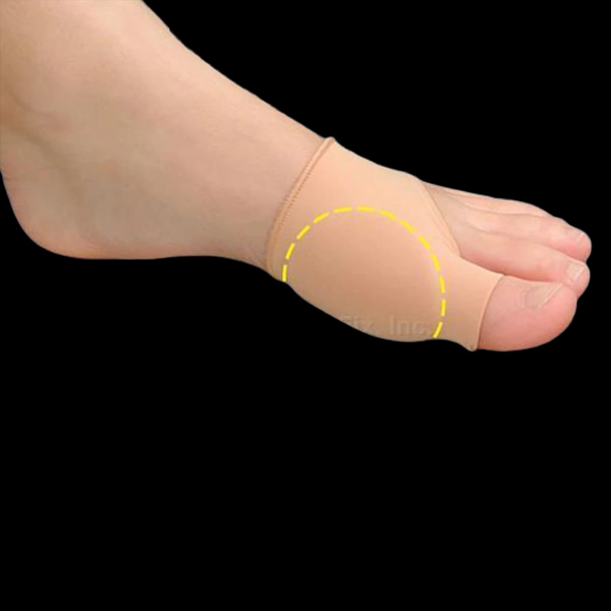 Pedifix Visco-GEL Bunion Care Relief Sleeve, Covered, Large/X-Large, 5mm - Bunion Sleeve Covered EP - Image 1