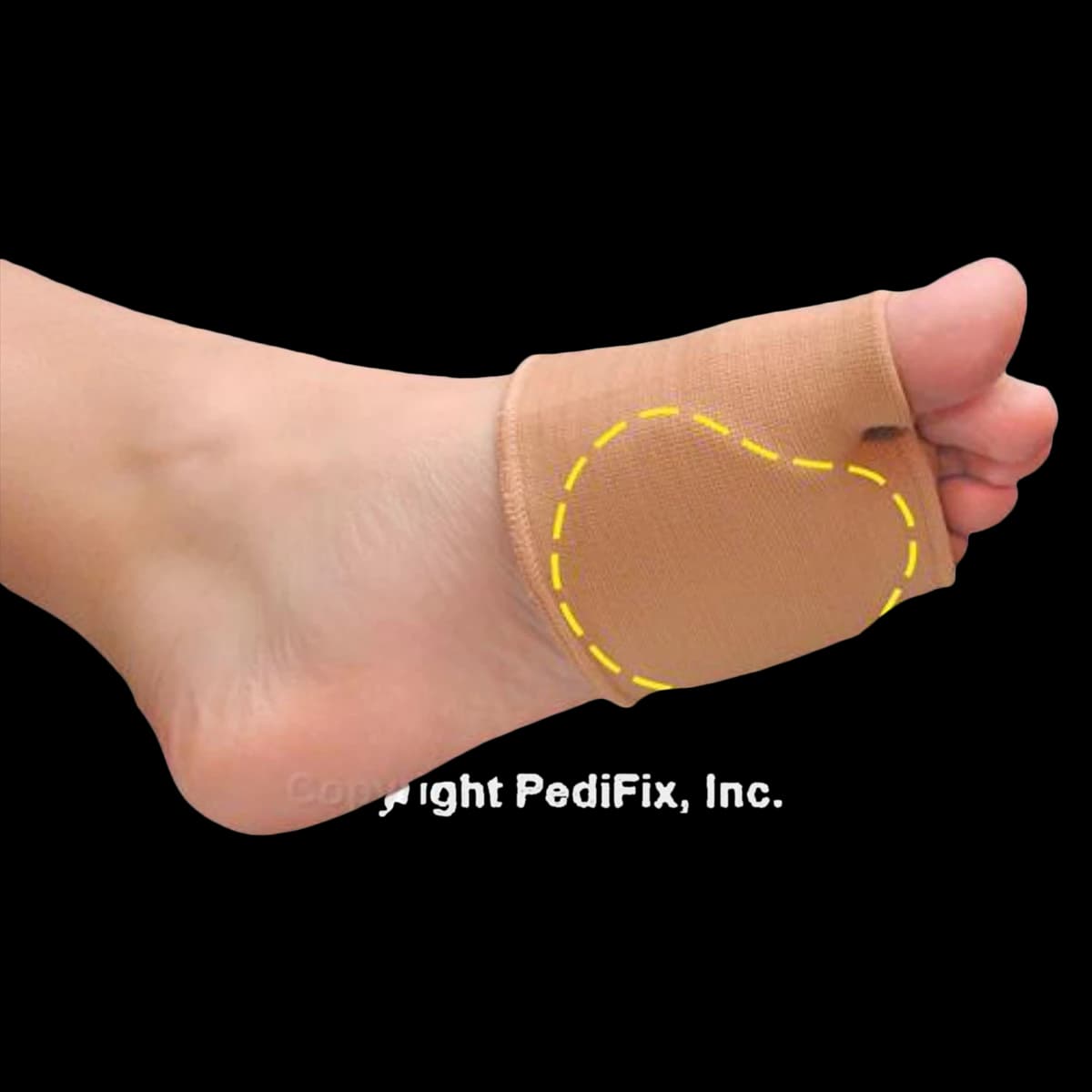 Pedifix Uni.Gel Metatarsal Strap, Right Foot, Large/X-Large - Uni.Gel Met Strap Right - Image 1