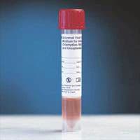 BD Viral Transport Vial, Universal, 3 mL, 50/Package - Transport Vial Universal - Image 1