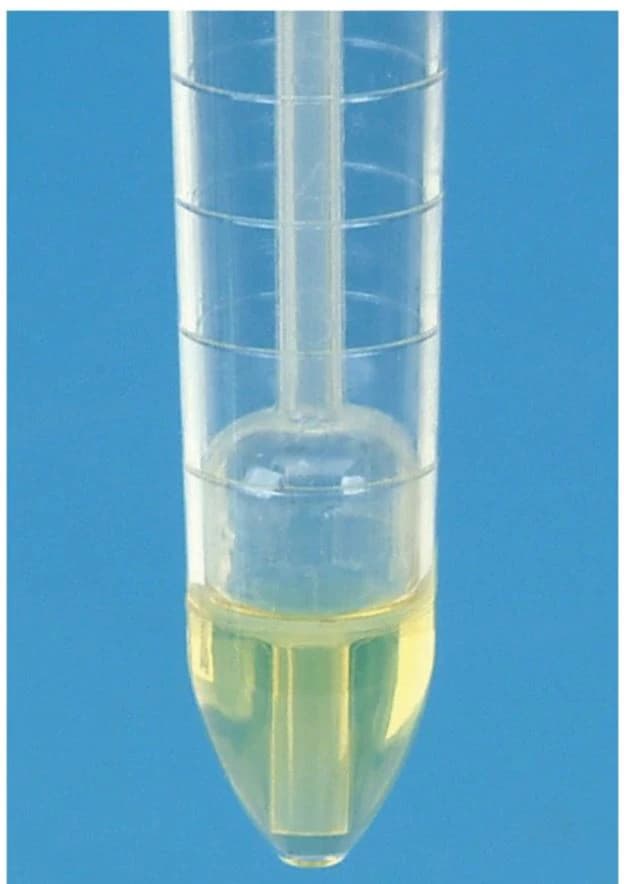 Fisherbrand Polystyrene Tube Caps for Urine Sedimentation System, White, 1000/Case - Caps Tubes Urine Sedimentation - Image 1