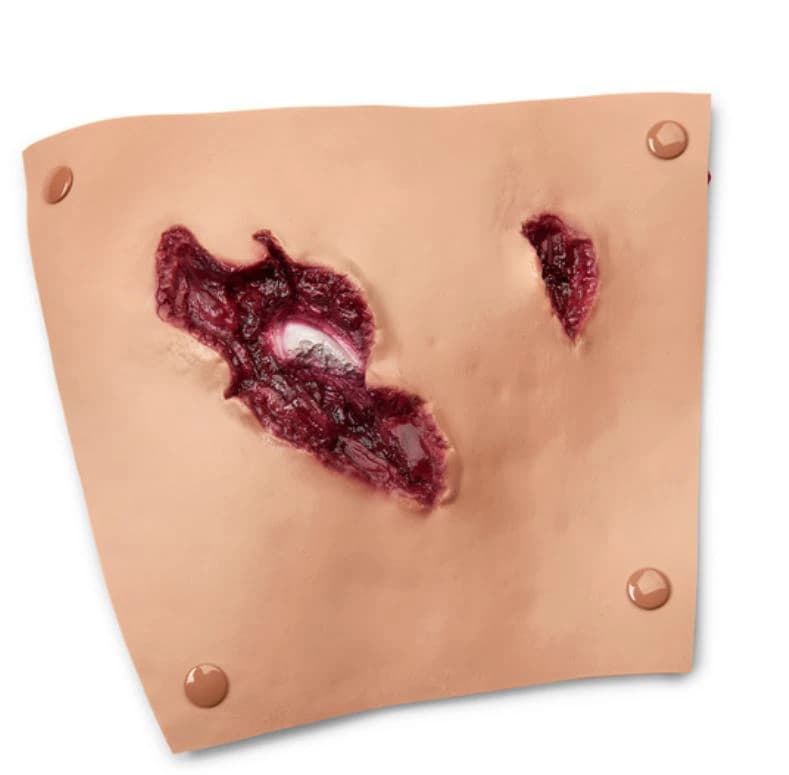 Nasco Healthcare Compound Fracture Femur Moulage for EMT Casualty Kit - Compound Fracture Femur - Image 1