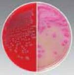 Remel Blood Agar TSA Plate 5%, Trypticase Soy Agar Biplate, 100/Case - Blood Agar TSA Plate 5% - Image 1