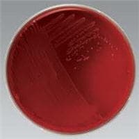 Remel Bovine Albumin Fraction V, 0.2% Solution, 50 mL - Bovine Albumin FractionV, 0.2% - Image 1
