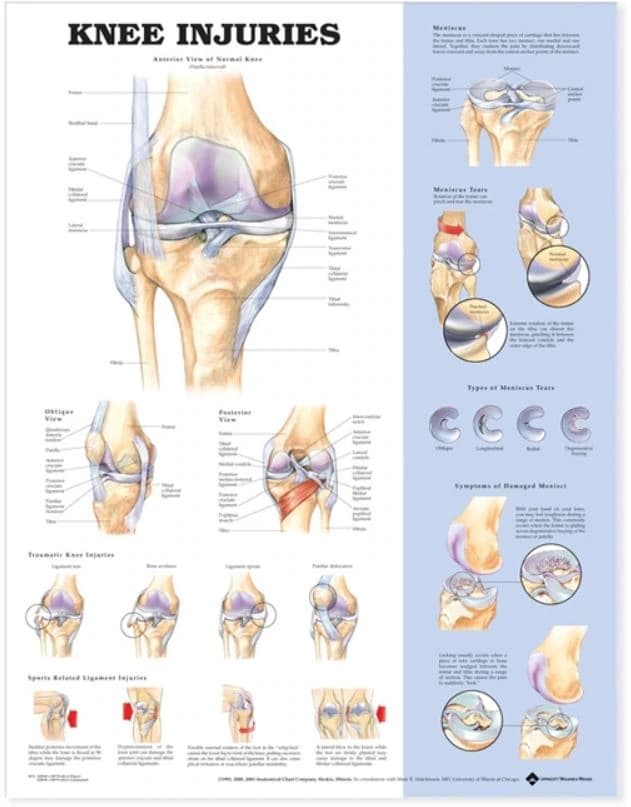 Knee Injuries Anatomical Chart, Mounted, 20" x 26" - Chart Knee Injuries Paper - Image 1