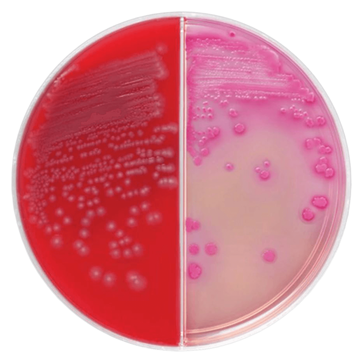 Remel BAP/MAC Biplate Media, Trypticase Soy Agar with 5% Sheep Blood and MacConkey Agar, 10/Package - BAP/MAC Biplate Media - Image 1