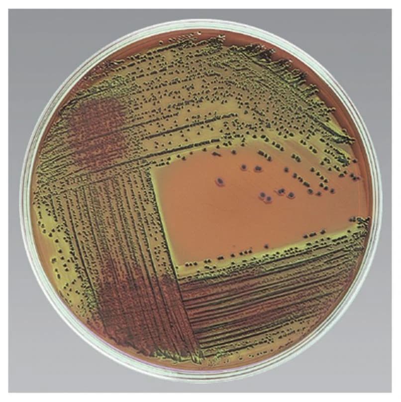 Remel EMB Levine Agar Prepared Monoplate, 100/Package - EMB Levine Agar - Image 1