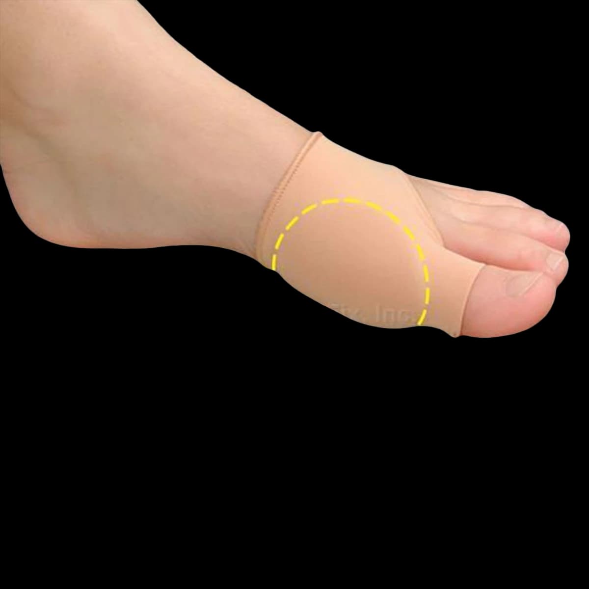 Pedifix Visco-GEL Bunion Care Sleeve, Uncovered Thin, Large/X-Large, 3mm - Bunion Sleeve Uncovered Thin - Image 1