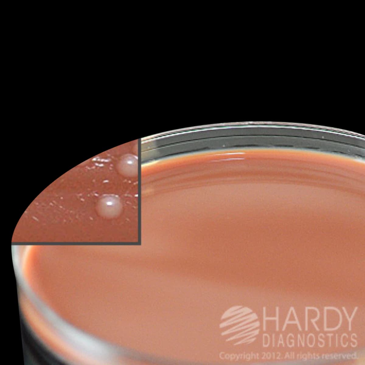 Hardy Diagnostics Thayer Martin Modified Plates, Neisseria Gonorrhoeae Test, 10/Package - Thayer Martin Mod Plts - Image 1
