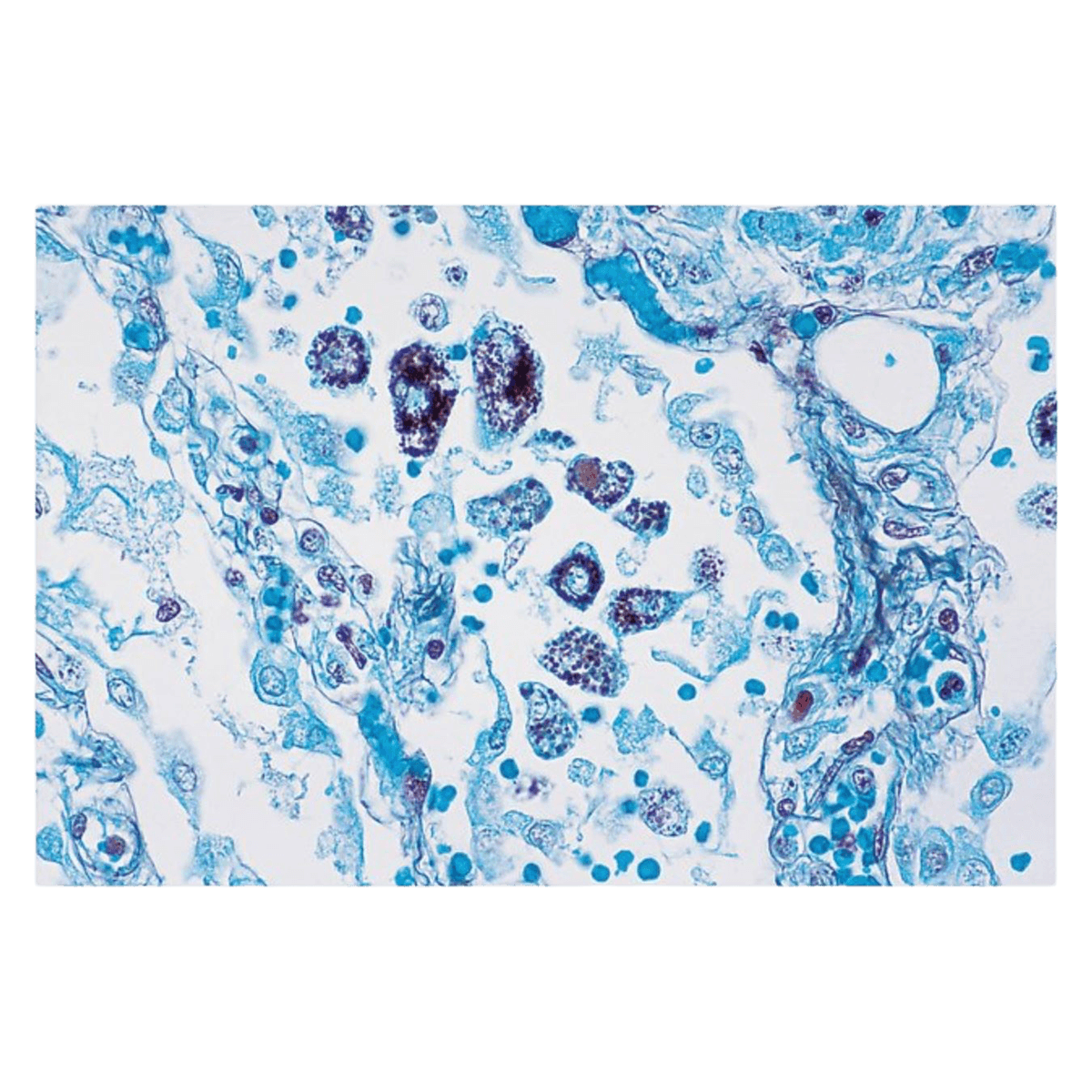 Richard-Allan Modified Grocott's Methenamine Silver Stain Kit - Silver Stain Kit - Image 1