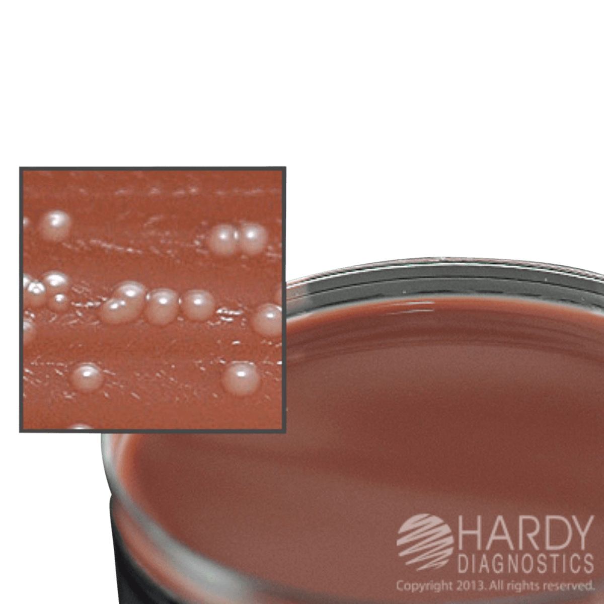 Martin Lewis Plate Agar, Neisseria Gonorrhoeae Culture, 15x100mm, 10/Package - Martin Lewis Plate Agar - Image 1