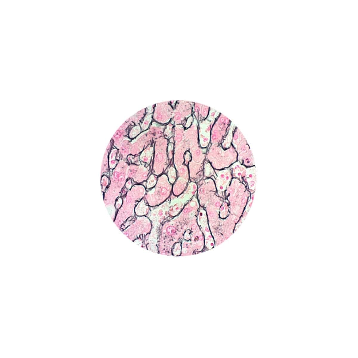 Azer Scientific Reticulum Stain Kit, Modified GMS, Each - Reticulum Stain Mod GMS - Image 1