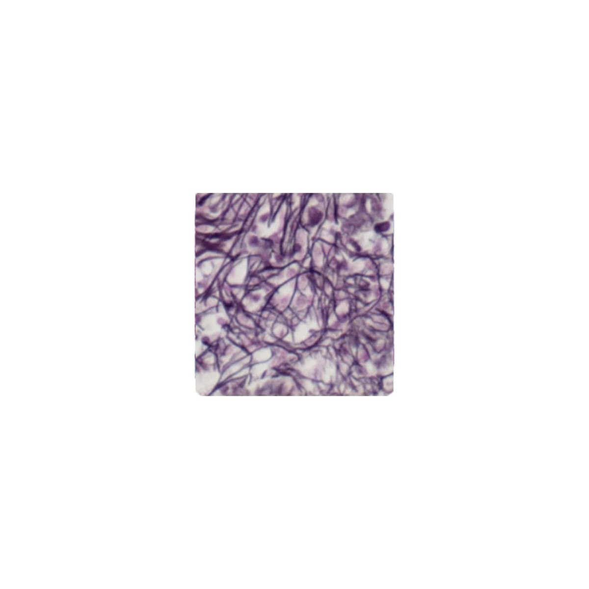 Azer Scientific Reticulum Stain Kit, Modified GMS, Each thumbnail 2