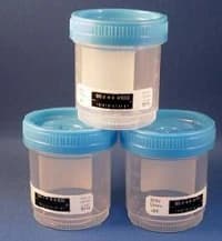 Andwin Scientific Specimen Container with Temperature Strip, 90 mL, Plastic, 100/Case - Container Specimen w/Tmp Strip - Image 1