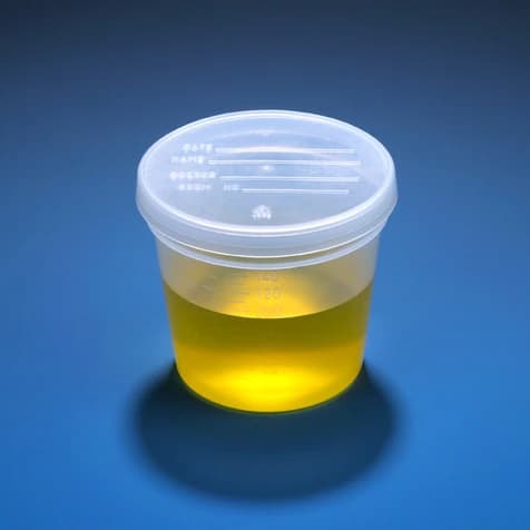 Globe Scientific Specimen Container, Polypropylene, 5 oz, Non-Sterile, Clear, with Molded Graduations and Separate Snap Lid, 300/Case - Container Specimen PP 5oz - Image 1