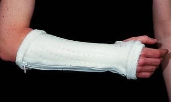 Aquaform Splint Wrist Short White, Aquaplast-T, Size Medium (6.25-7.25") - Splint Wrist Short White - Image 1