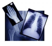 Agfa Green 400 X-Ray Film, 100 Sheets/Box - Film X-Ray AGFA Green 400 - Image 1