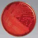 Agor Strep Selective Agar, 12x85mm Monoplate, 100/Box - Agor Strep Selective - Image 1