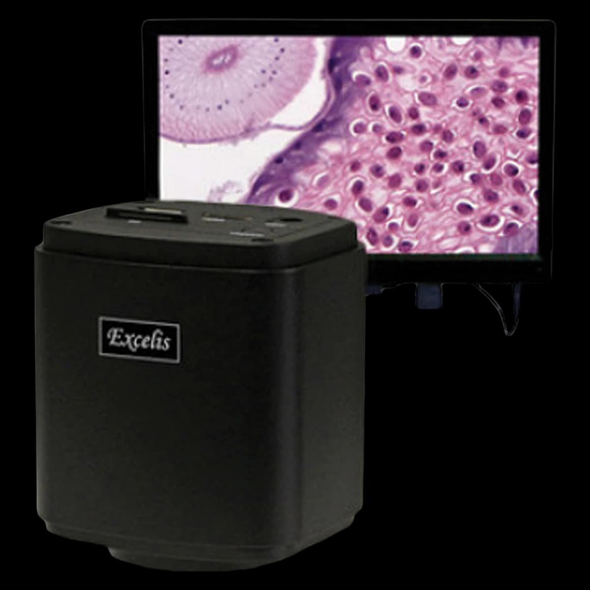 Accu-Scope Excelis HD Microscopy Camera with 11.6" Monitor, HDMI Cable, and 12V Adapter - HD Microscopy Camera w/Monitor - Image 1