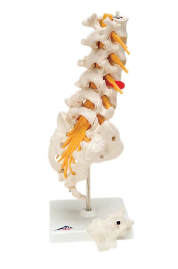 3B Scientific Lumbar Spinal Column Model, Educational Demonstration Model - Model Lumbar Spinal Column - Image 1