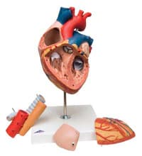 American 3B Heart with Esophagus and Trachea Anatomical Model, 5 Times Life Size, 5-Part - Heart with Espophagus Trachea - Image 1