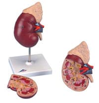 American 3B Kidney with Adrenal Gland Anatomical Model - Kidney w/Adrenal Gland - Image 1