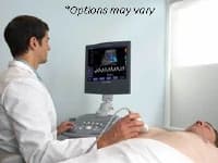 Siemens X150 Ultrasound System - Ultrasound System Siemens X150 - Image 1