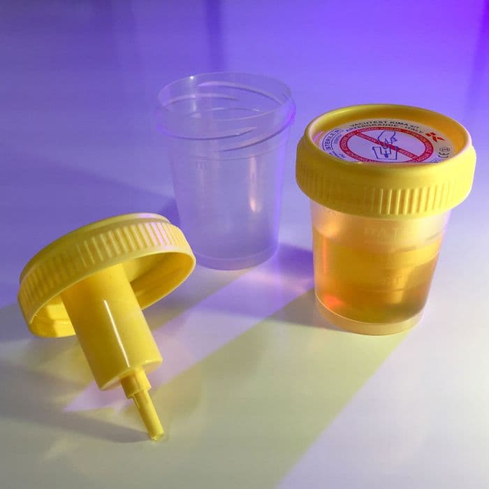 Globe Scientific TransferTop Urine Collection Cup, 60mL, Sterile, Individually Wrapped, with Integrated Transfer Device, Clear, 500/Case - Cup Urine w/ Transfer Device - Image 1