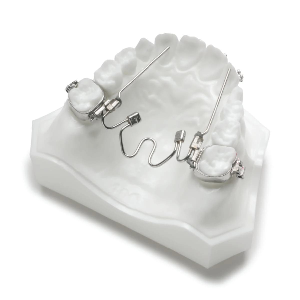 Nitanium Palatal Expander 2, 30mm - Nitanium PalatalExpander2 30mm - Image 1