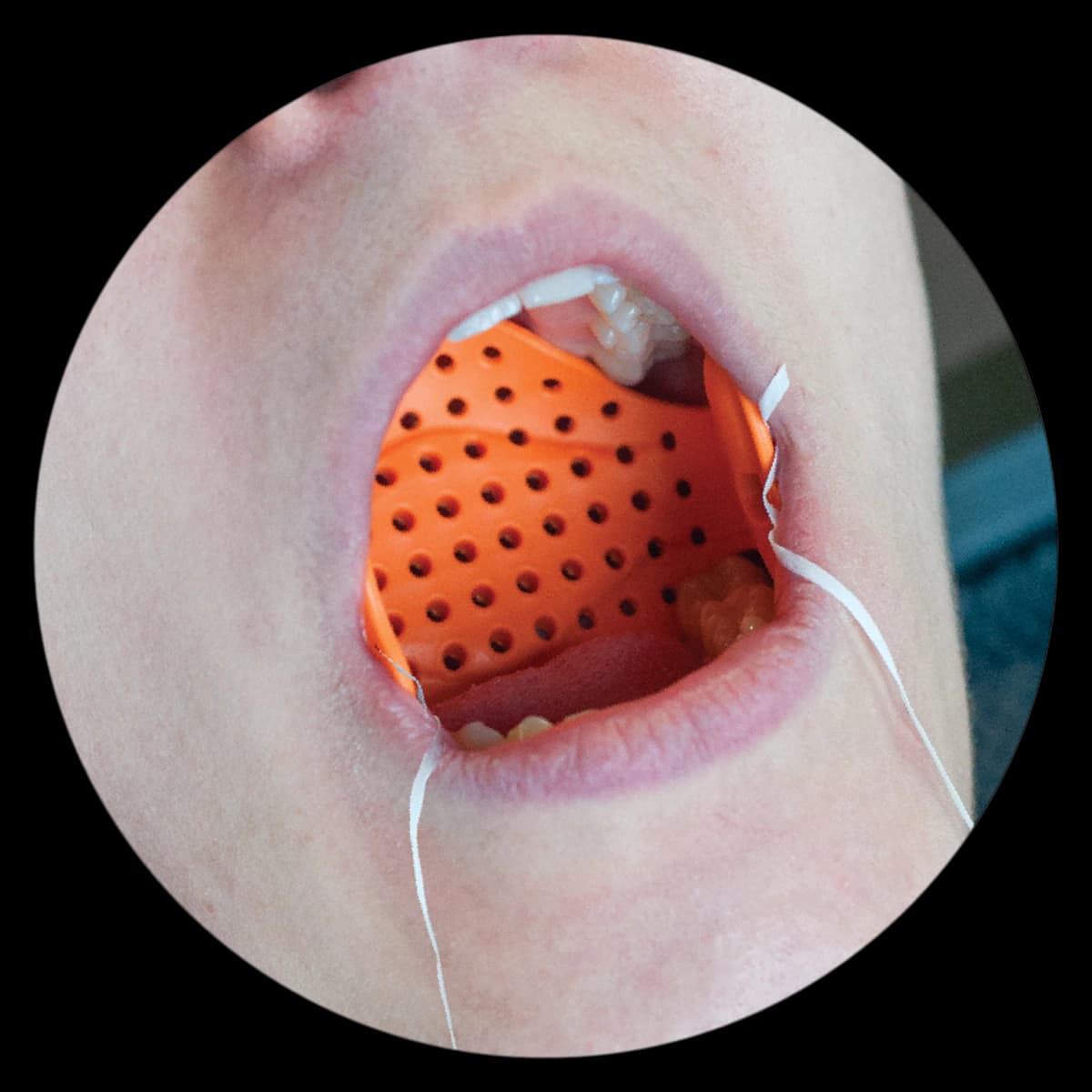 Zirc Airway Armor Large, Single-Use Aspiration/Ingestion Guard, Latex-Free, Orange, 25/Pack, 50Z960LG - Airway Armor Large 25/Pack 50Z960LG - Image 1