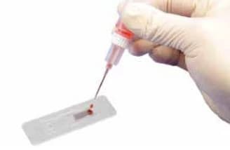 Cardinal Health Diff Dropper for Blood Specimen, Single Drop Release, 1000/Case - Dropper Diff Manual Single Drp - Image 1