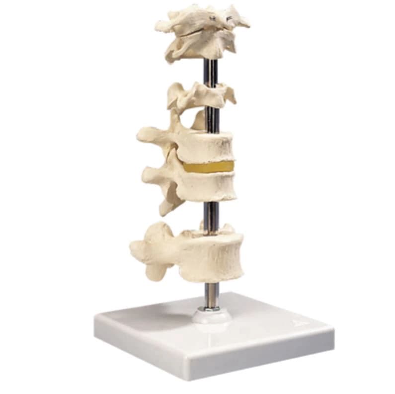 3B Scientific Vertebra Column Anatomical Model, 6-Part, Mounted, 1 lb - 6 Mounted Vertebrae Model - Image 1