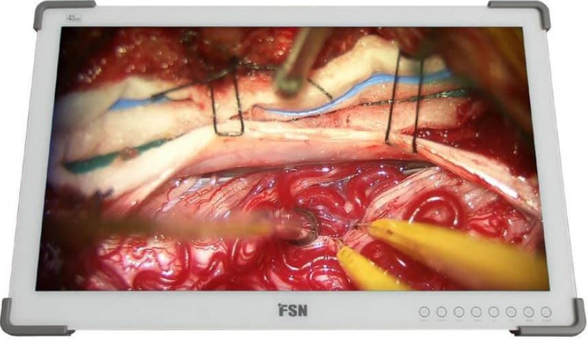 FSN Medical Technologies 27" 4K UHD Medical Monitor - Medical Monitor 4k UHD 27" - Image 1