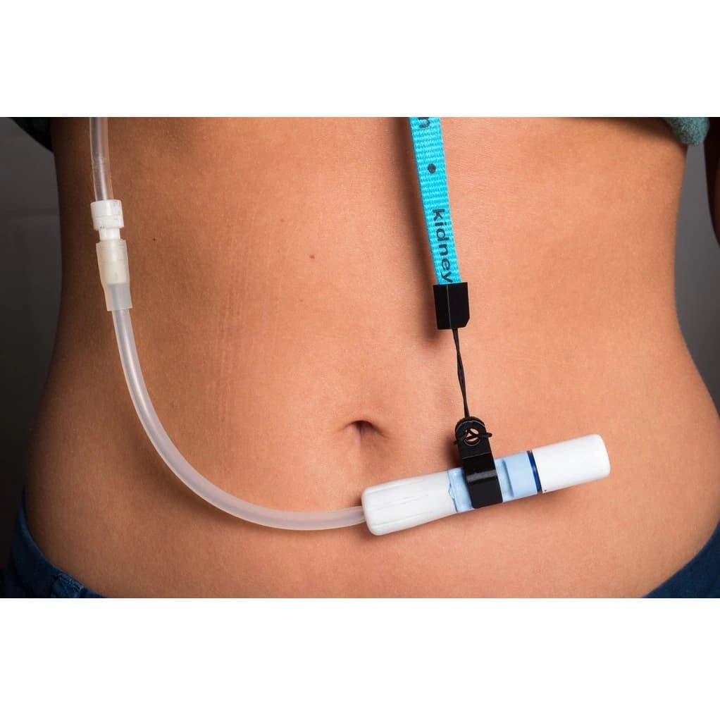 PD Showermate Catheter Clip Lanyard, Non-Sterile, Reusable, Each - PD Showermate - Image 1