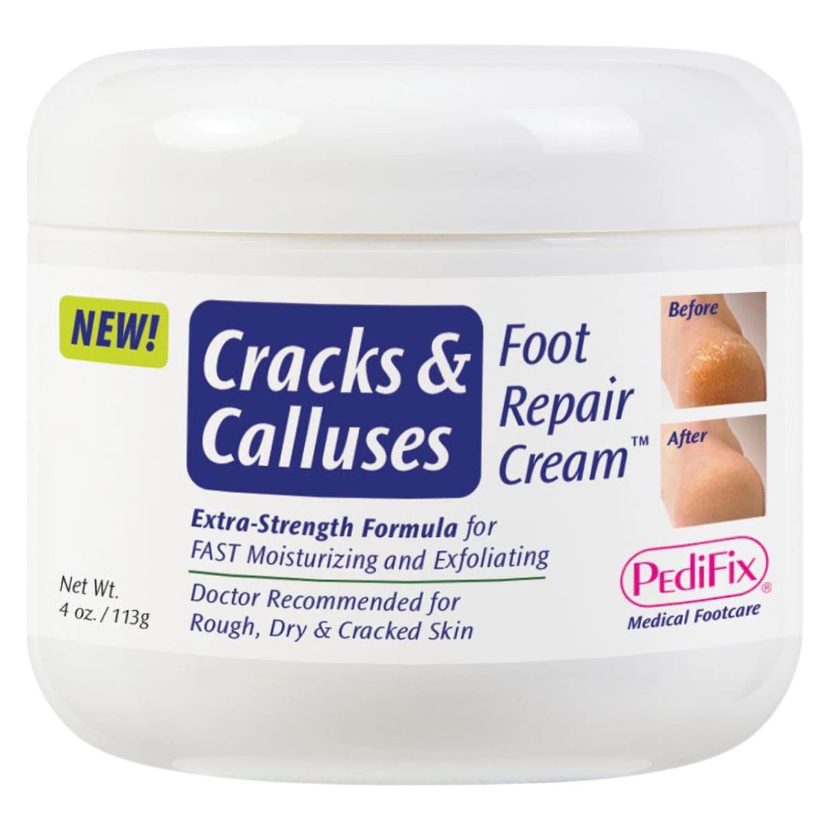 Pedifix Cracks & Calluses Repair Cream, Foot, Opaque White, 4 oz Tube - Cream Cracks & Calluses Repair - Image 1