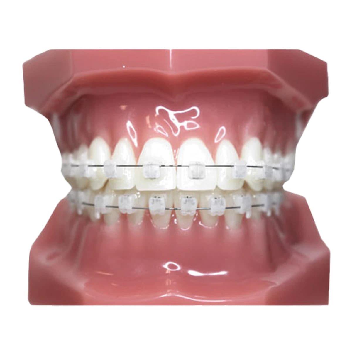 Typodont Carriere SLX 3D Clear - Typodont Carriere SLX 3D Clear - Image 1