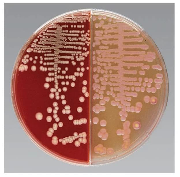 Remel Biplate Agar Columbia CNA with 5% Sheep Blood, 100/Package - Biplate Agar Columbia CNA - Image 1
