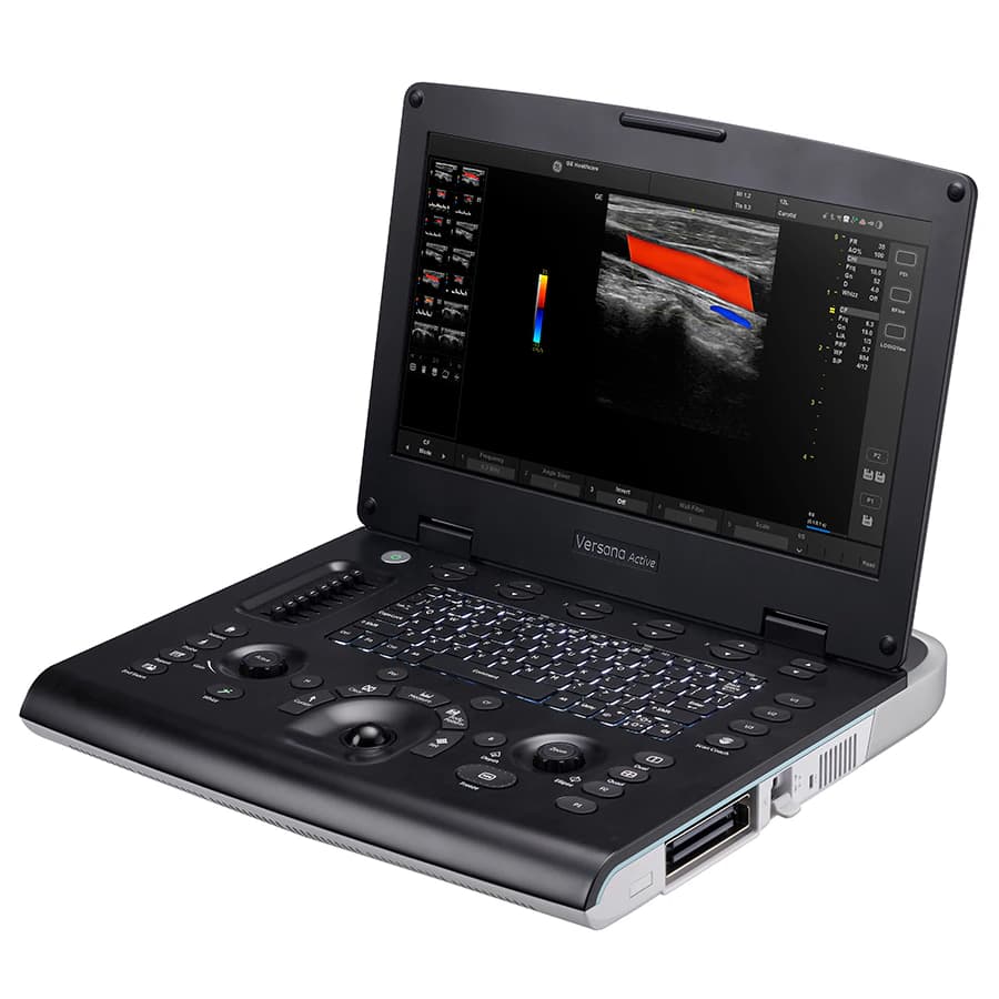 GE Versana Active Ultrasound System - Ultrasound System Versana Actv - Image 1