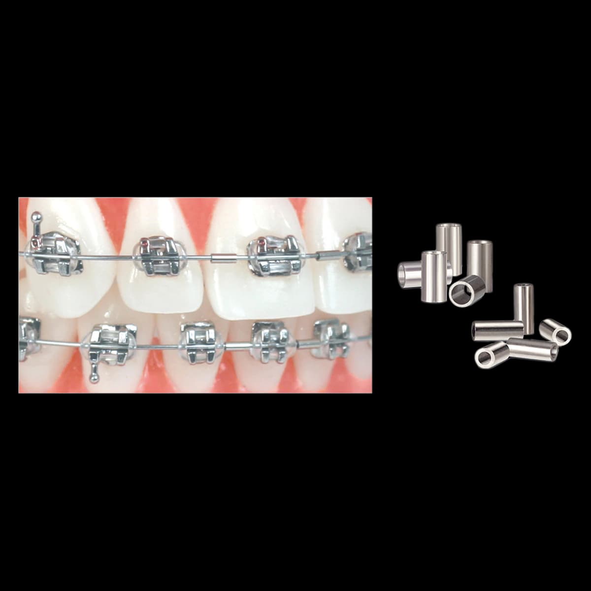 Ortho Technology Crimpable Mini Stops, Small, Stainless Steel, 25/Pkg, 020-200 - Crimpable Mini Stops -Small - Image 1