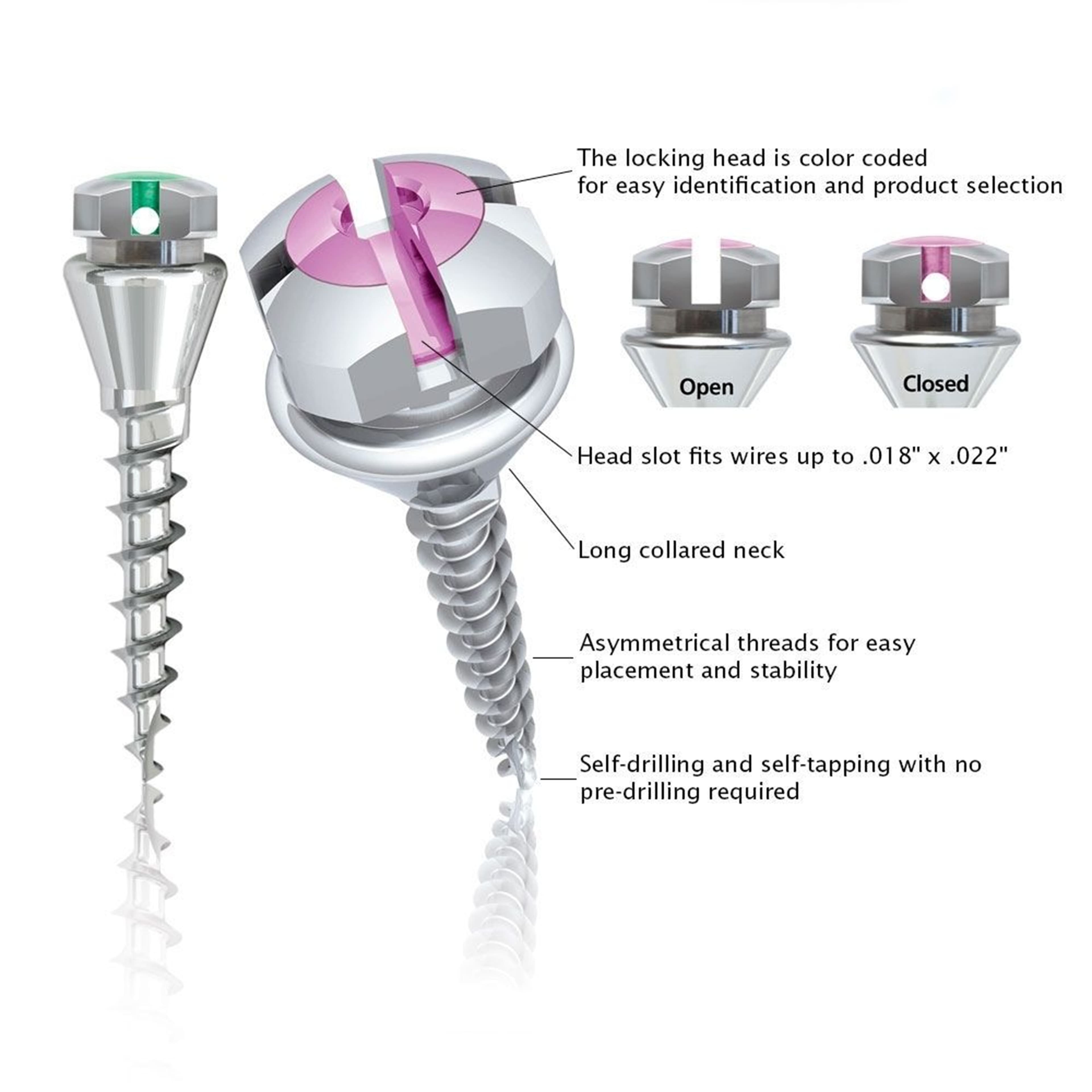 Ortho Technology Spiderscrews Long Neck, Self-Ligating TAD K1, 8 mm thumbnail 2