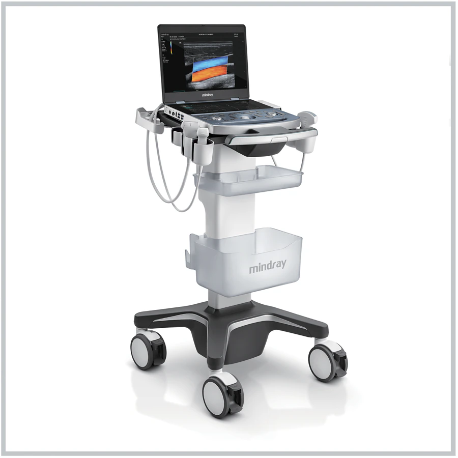 Mindray MX7 Portable Ultrasound System - Ultrasound System Portable MX7 - Image 1