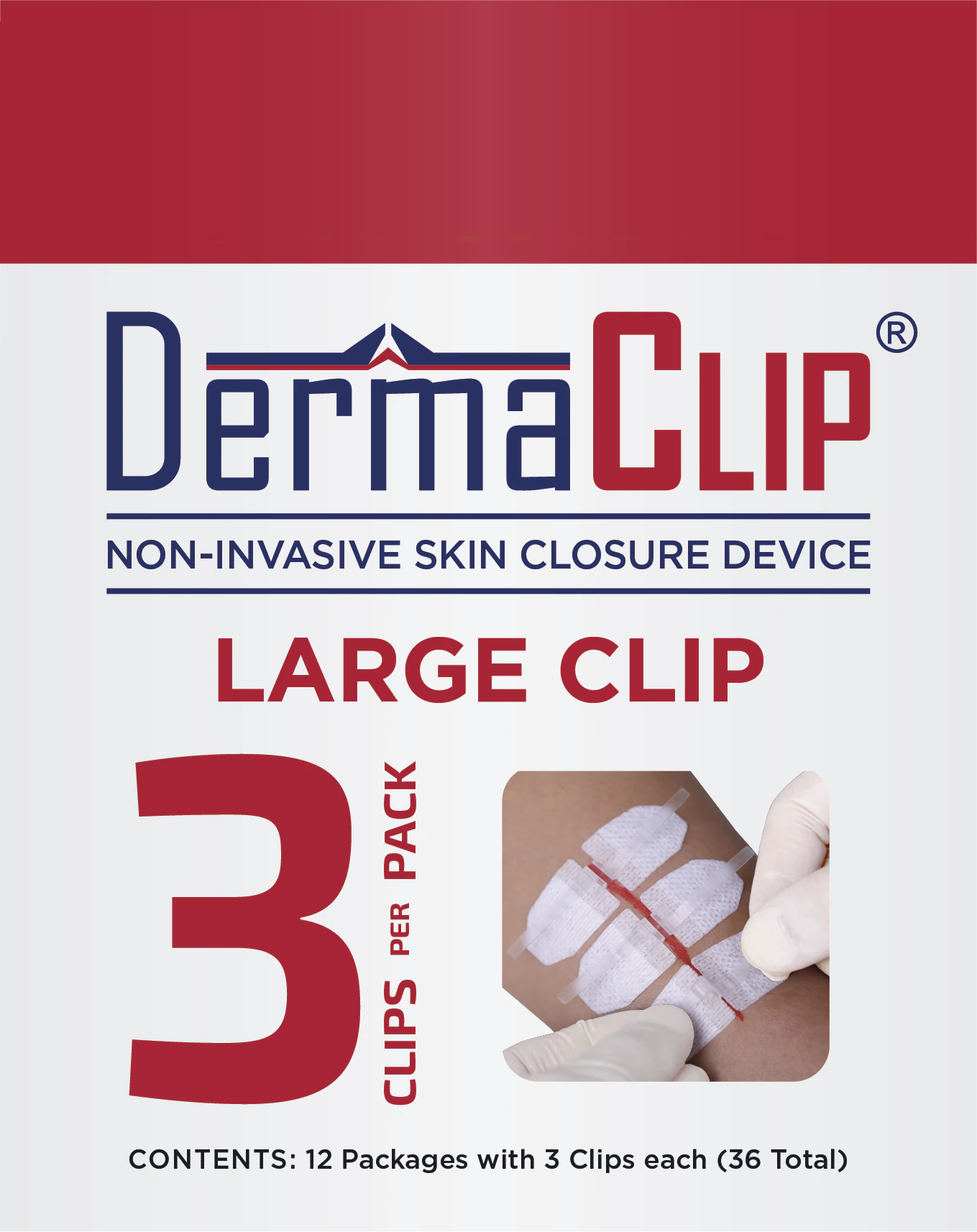 DermaClip Wound Closure Device, Large (21mm), White, Sterile, 12/Box - DermaClip 3" Large 21mm - Image 1