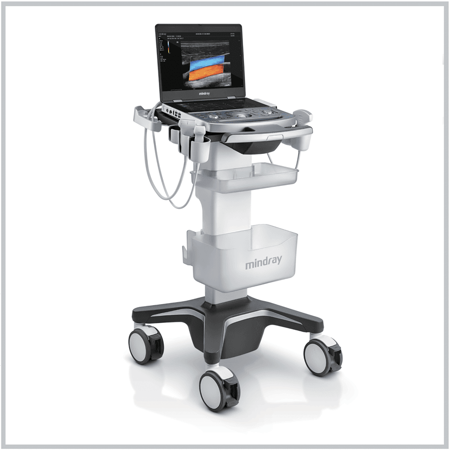 Mindray MX7 Portable Ultrasound System with Lithium-Ion Battery Pack thumbnail 2