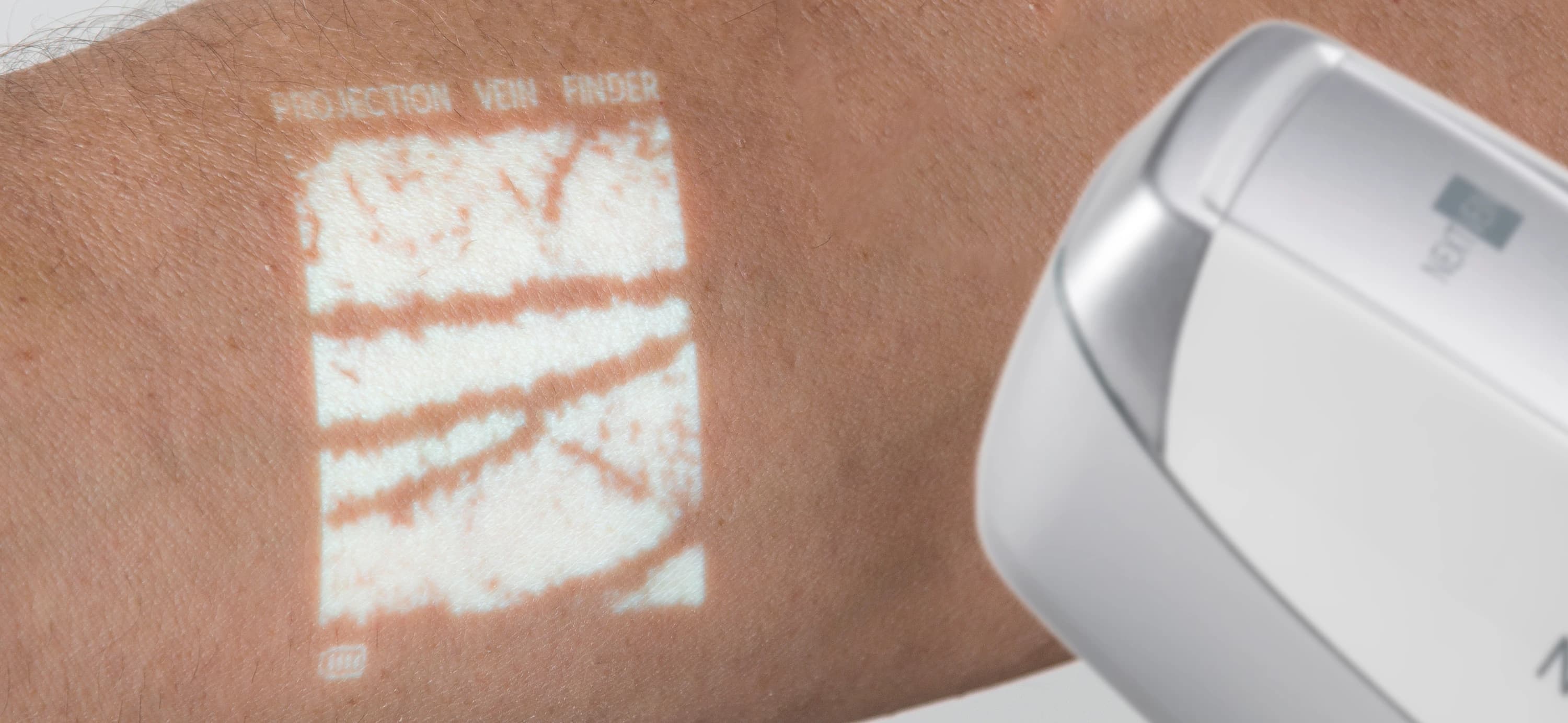 NextVein Vein Finder System thumbnail 3