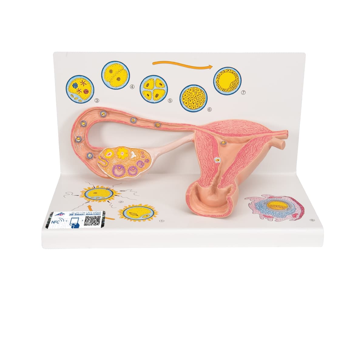 American 3B Scientific Ovaries and Fallopian Tubes Training Model - Model Training Ovaries And Fll - Image 1