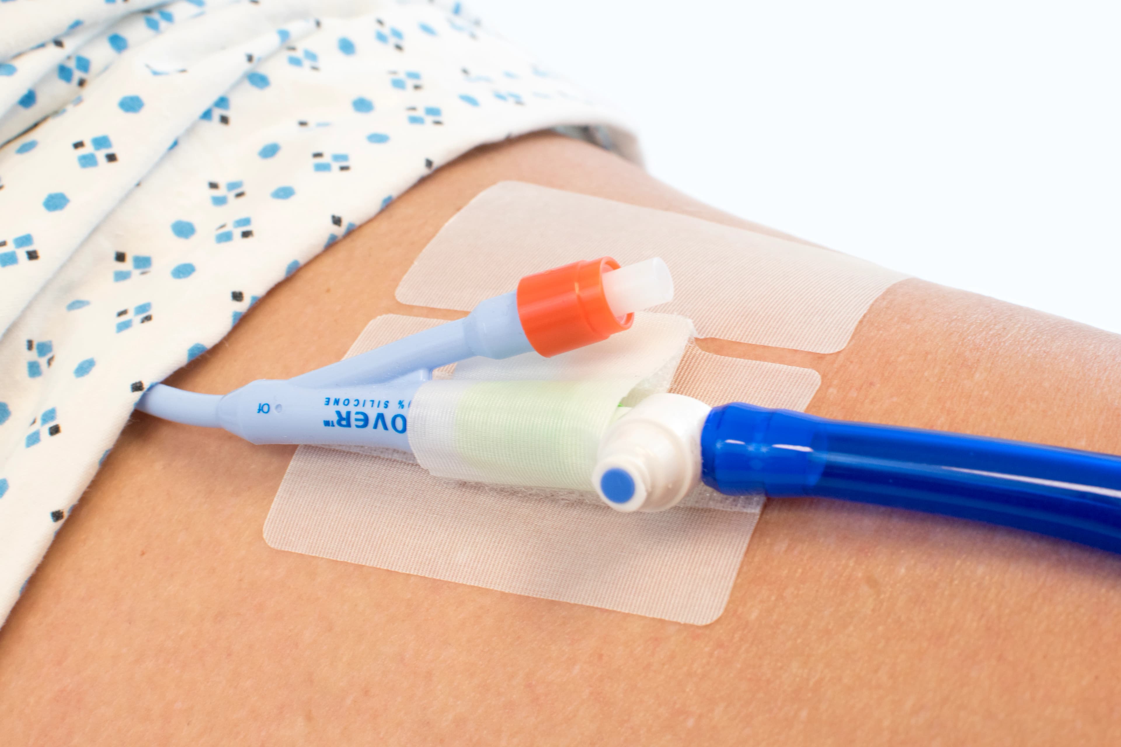 Cath-Secure Tube Secure Device, Catheter Securement - Cath-Secure Tube Secure Device - Image 1