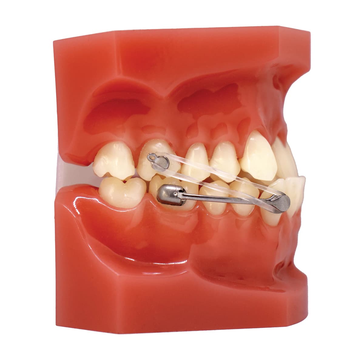 Carriere Motion Pro Class III Typodont - Carriere Motion Pro Class III - Image 1