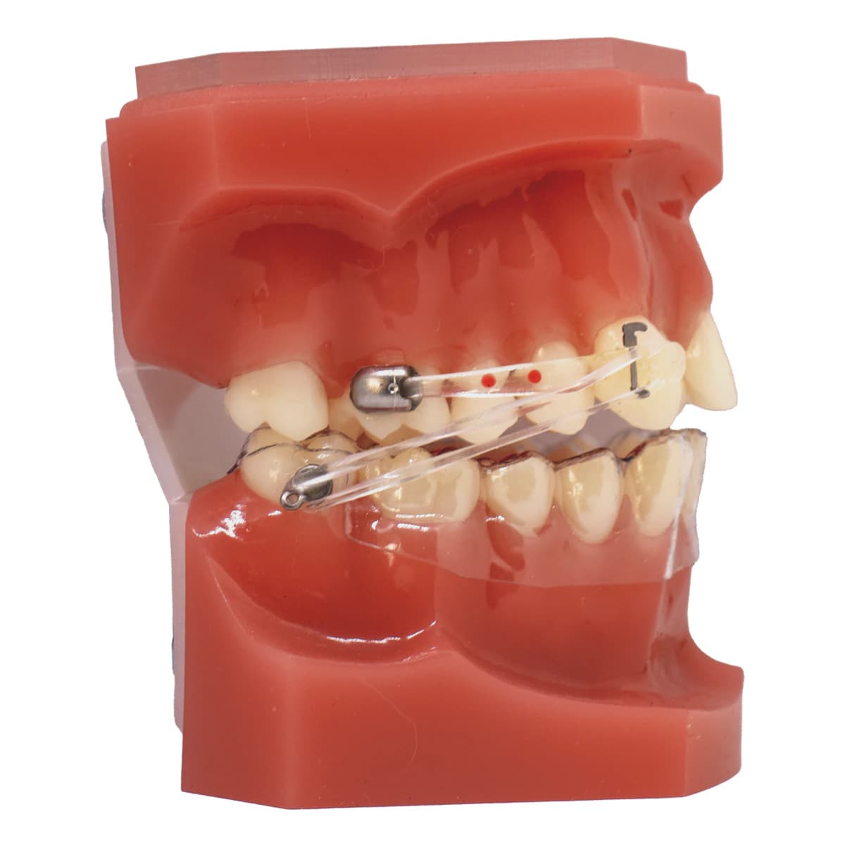 Carriere Motion Pro Clear Class Typodont - Carriere Motion Pro Clear Clas - Image 1