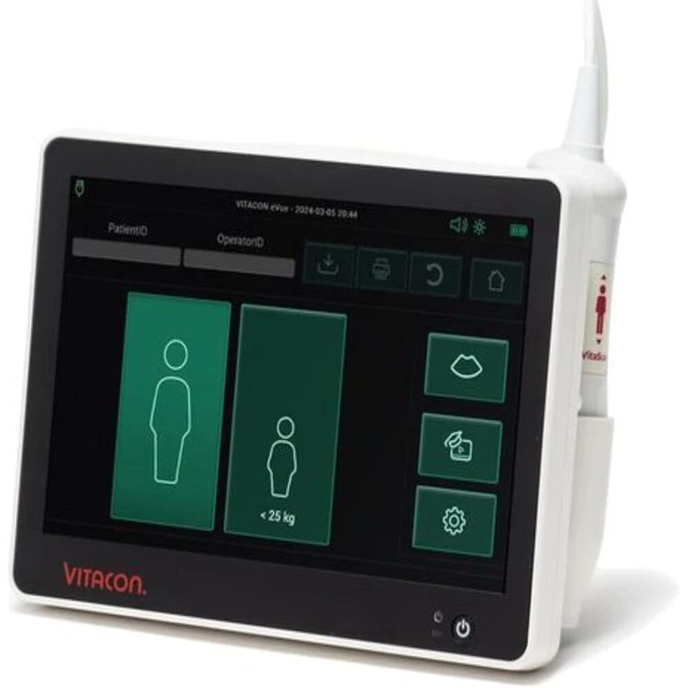 Vitascan eVue Bladder Scanner with Probe, Monitor, Built-in Printer, and Carrying Case - Scanner Bladder Vitascan eVue - Image 1