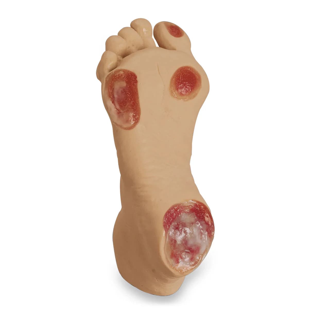 Life/form Foot Pressure Ulcer Training Model, Light Skin, Elderly, Each - Pressure Ulcer Foot Light - Image 1