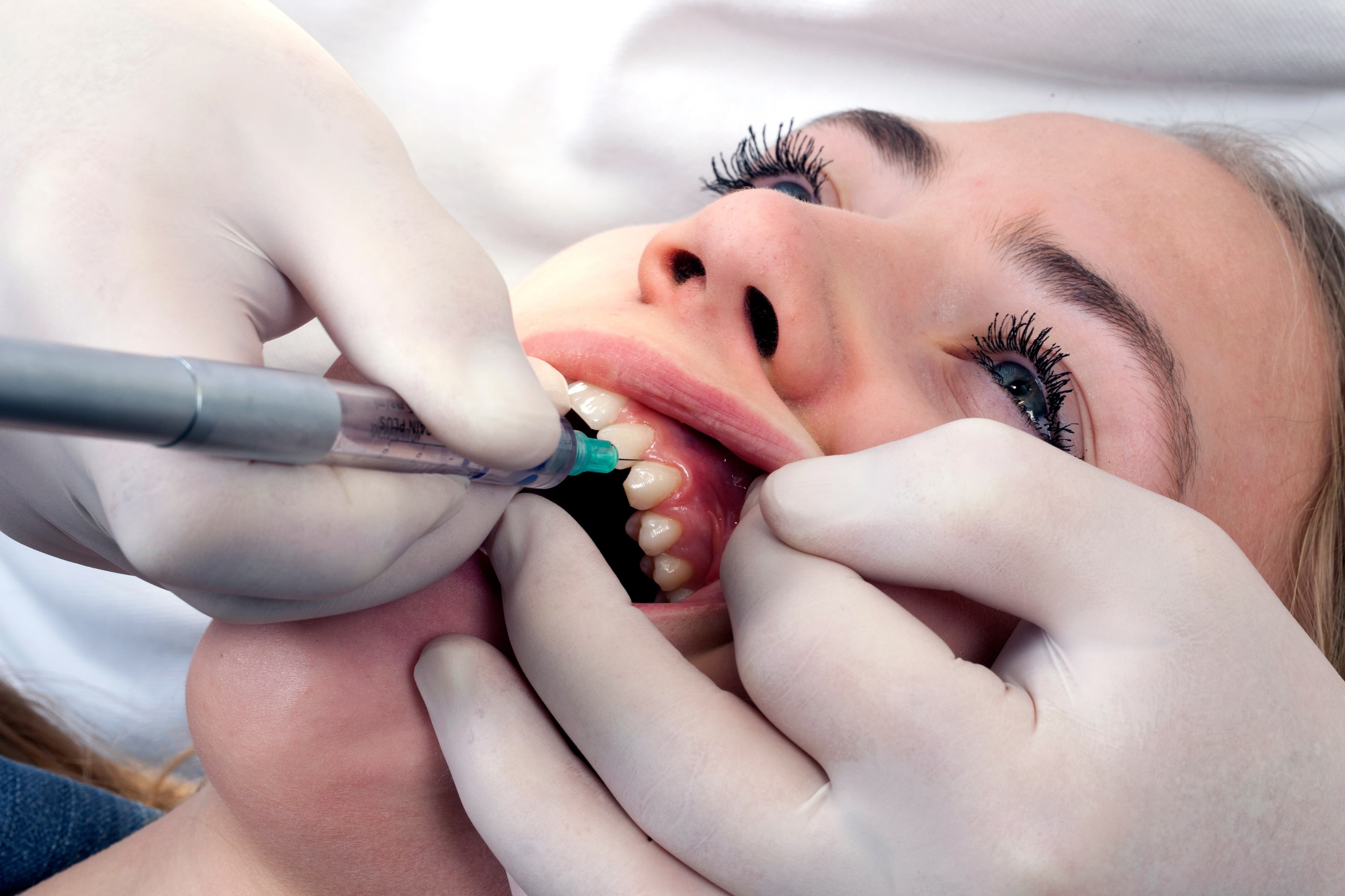 Calaject™ Computer-Assisted Local Anesthesia Delivery System, Complete Kit, 2118 thumbnail 2